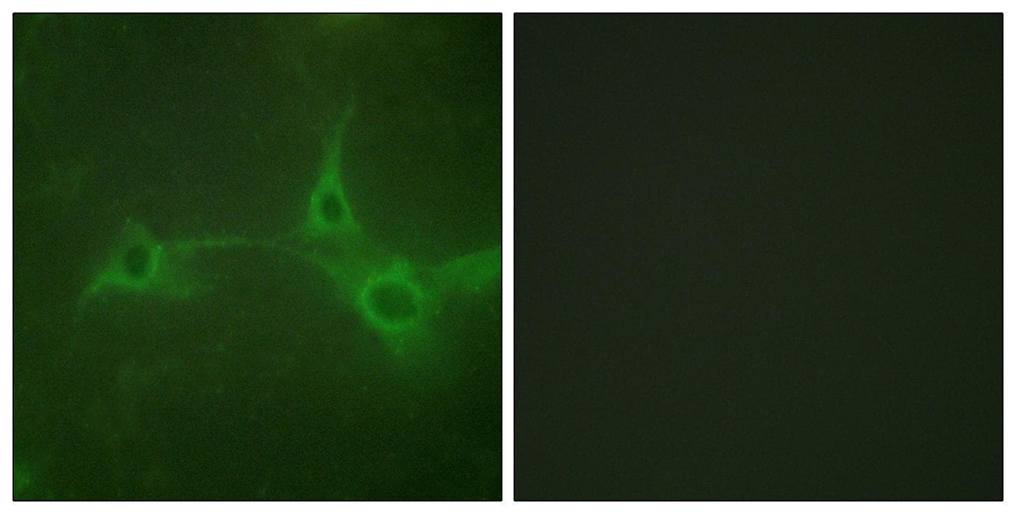 Polyclonal Rabbit anti-Human ADAM17 / TACE Antibody (aa701-750, IF)