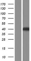 LHX8 Protein (Over-Expression Lysate Myc-DDK (Flag))