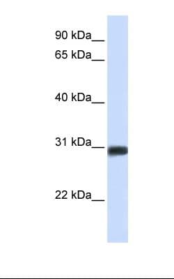 Polyclonal Rabbit anti-Human BARX2 Antibody (N-Terminus, WB)