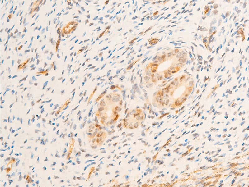 Polyclonal Rabbit anti-Human TK1 / TK / Thymidine Kinase Antibody (phospho-Ser13, IHC, IF, WB)