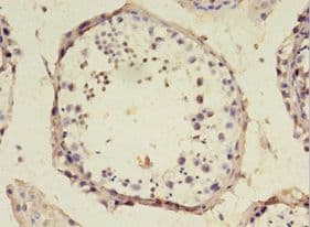 SRSF10 / FUSIP1 Antibody (aa1-183)
