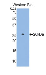GCLC Antibody (aa429-637)