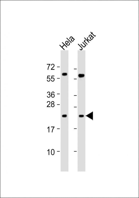 PSMB6 Antibody (aa151-185)