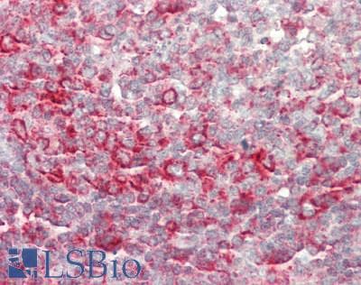 IHC-plus™ TRIM25 Antibody (clone 5C3)