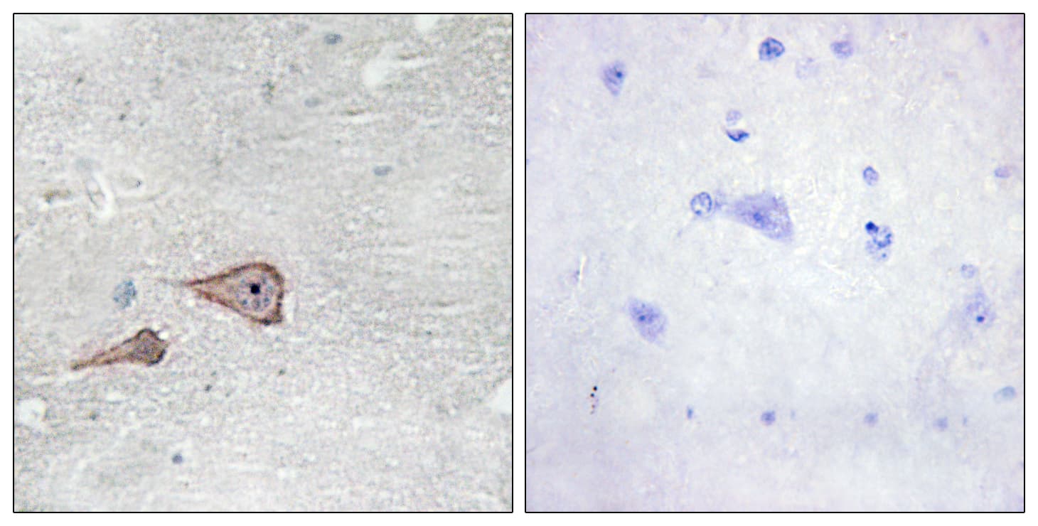 Polyclonal Rabbit anti-Human CDH3 / P-Cadherin Antibody (aa51-100, IHC, WB)
