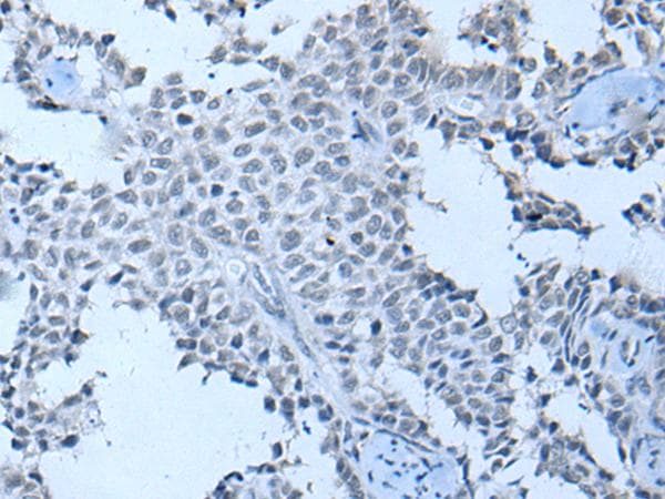 Polyclonal Rabbit anti-Human ZNF703 Antibody (IHC)