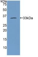 SMMHC / MYH11 Antibody (aa211-482, APC)