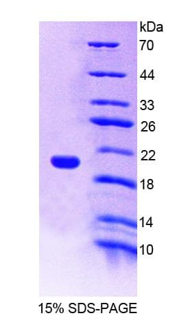 Human NRP1 / Neuropilin 1 Protein (Recombinant His)