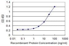 IHC-plus™ RTKN2 Antibody (clone 2C2)