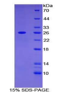 Human ADCY6 / Adenylate Cyclase 6 Protein (Recombinant 6His, N-terminus)