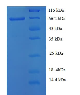 Human KRT38 / Keratin 38 / KRTHA8 Protein (Recombinant His-SUMO)
