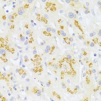 CD95 / FAS Antibody