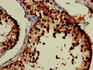 EIF3M / PCID1 Antibody