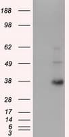 ERCC1 Antibody (clone OTI2D8)