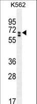 CLIP3 Antibody (aa368-396)