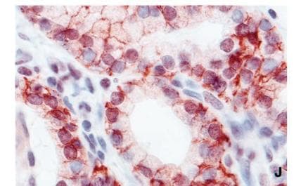 Monoclonal Mouse anti-Human SLC5A5 / NIS Antibody (clone 14F, aa625-643, IHC, WB)