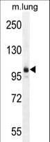 Polyclonal Rabbit anti-Human ACLP / AEBP1 Antibody (aa334-364, WB)