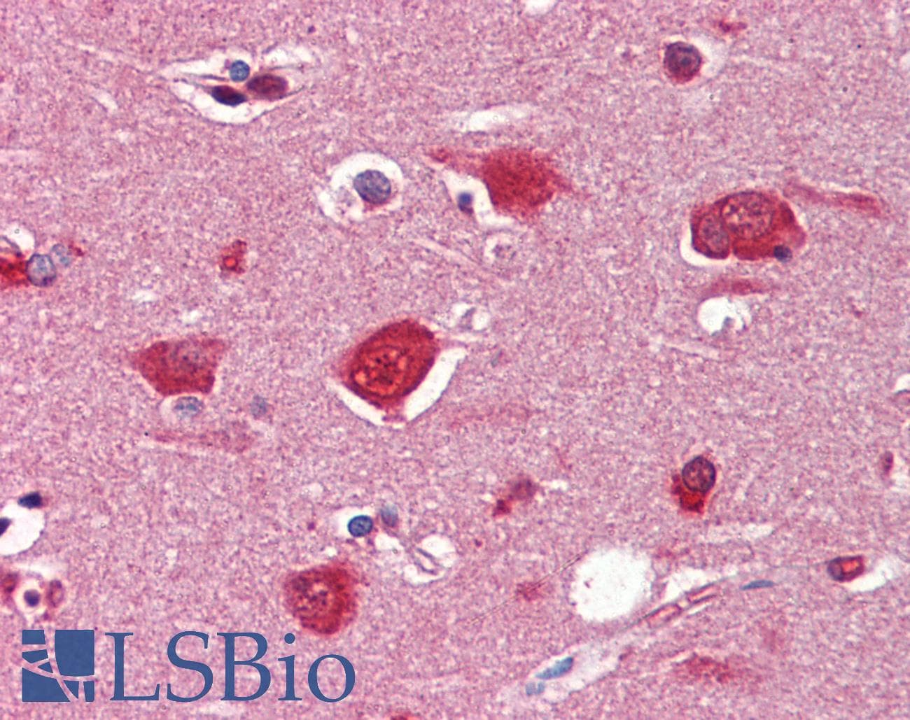 IHC-plus™ Collagen I Antibody