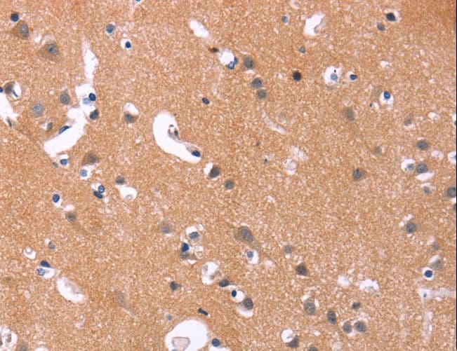 MAPK11 / SAPK2 / p38 Beta Antibody