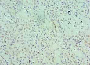 Polyclonal Rabbit anti-Human SRSF1 / SF2 Antibody (aa1-248, IHC)