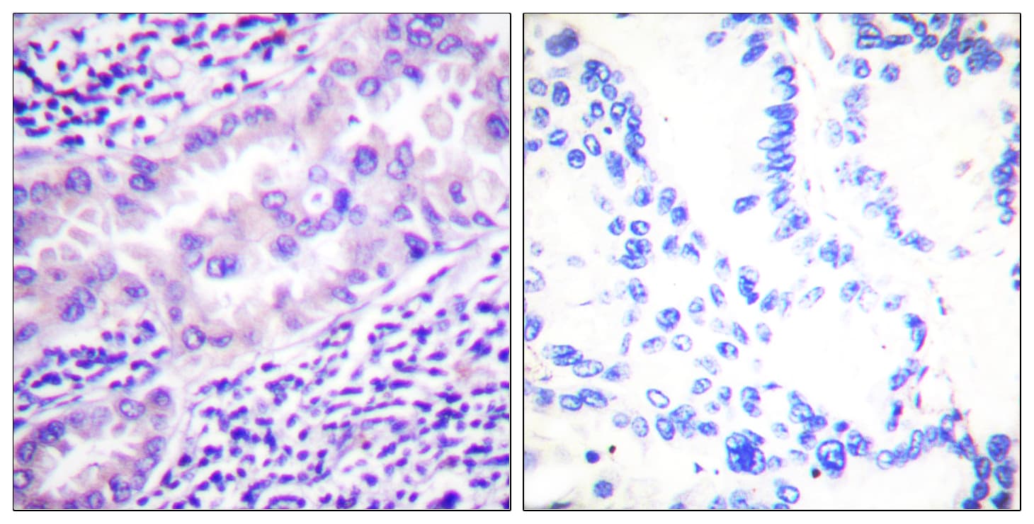 PP2Ac / PPP2CA Antibody (phospho-Tyr307)
