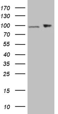 KPNB1 / Importin Beta Antibody (aa1-200, clone OTI10D3)