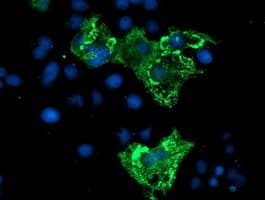 ZBED1 / TRAMP Antibody (clone OTI2A7)