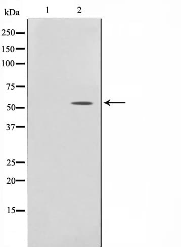 TP53 / p53 Antibody (phospho-Ser15)