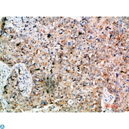 LAMP3 / CD208 Antibody