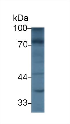 NEXN / Nexilin Antibody (aa421-607)