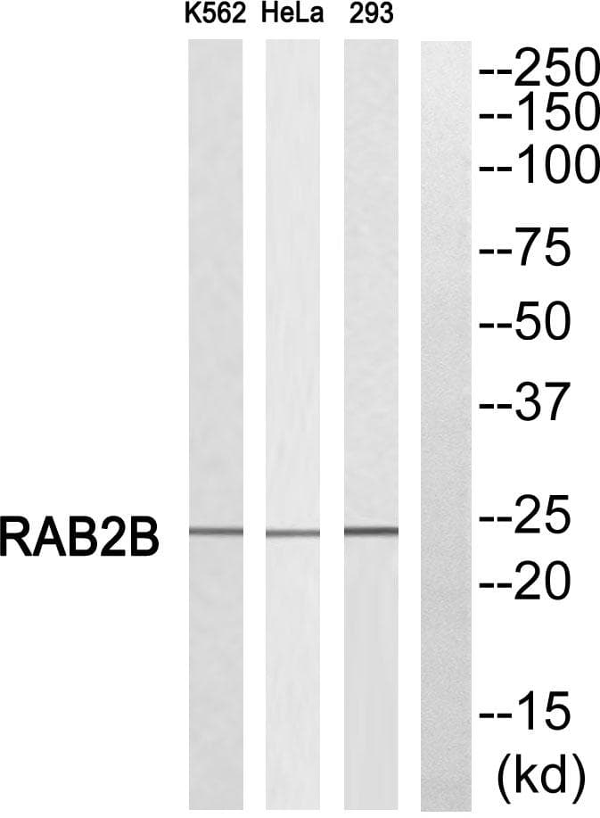 RAB2B Antibody