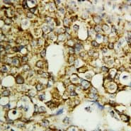 TFPI2 Antibody (Internal)