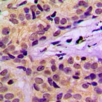 c-CBL Antibody (phospho-Tyr674)