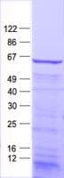 Human MYOT / Myotilin Protein (Recombinant His, N-Terminal)