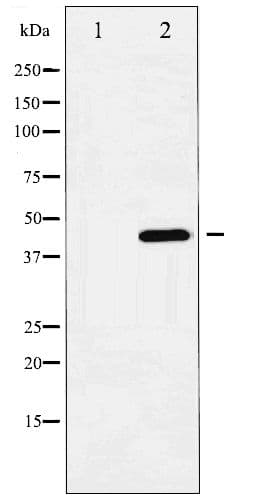Polyclonal Rabbit anti-Human HDAC3 Antibody (phospho-Ser424, IHC, IF, WB)