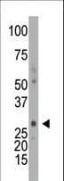 DCK / Deoxycytidine kinase Antibody (aa171-200)