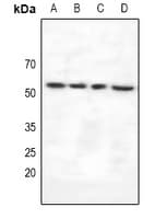 Polyclonal Rabbit anti-Human VRK3 Antibody (WB)