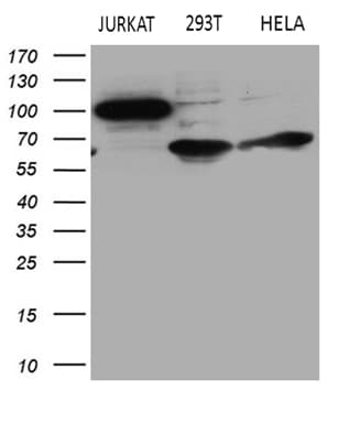 Monoclonal Mouse anti-Human APBB1IP / RIAM Antibody (clone OTI6E3, IHC, WB)