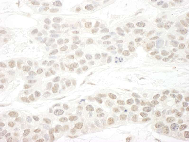 Polyclonal Rabbit anti-Human SETD1B / SET1B Antibody (aa350-400, IHC)