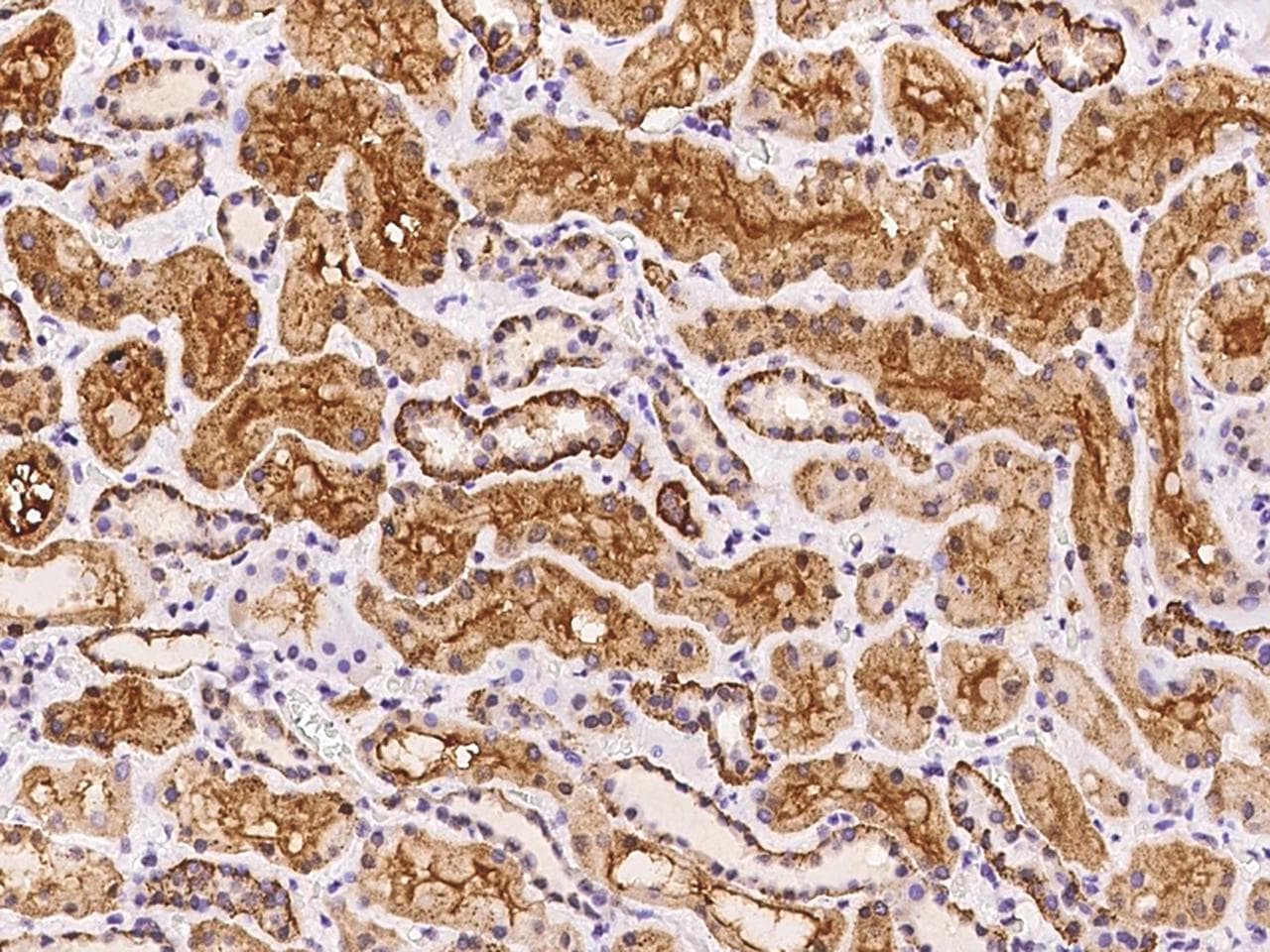 SPECC1L Antibody