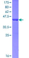 Human HRSP12 / UK114 Protein (Recombinant GST)