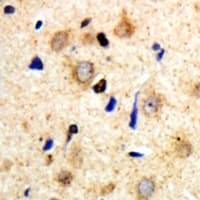 MYH14 Antibody (Internal)
