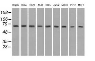 HSPA9 / Mortalin / GRP75 Antibody (clone OTI9F8)