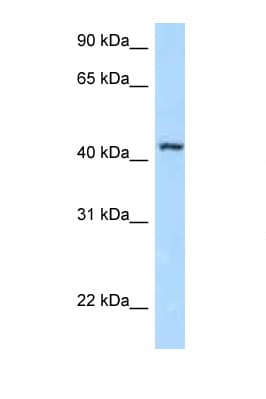 FBL8 / FBXL8 Antibody (aa53-102)