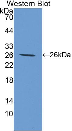 TGM3 / Transglutaminase 3 Antibody (aa468-693, APC)