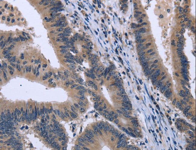 KCNJ11 / Kir6.2 Antibody
