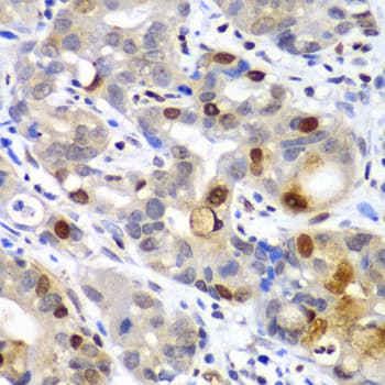 SUMO2 Antibody