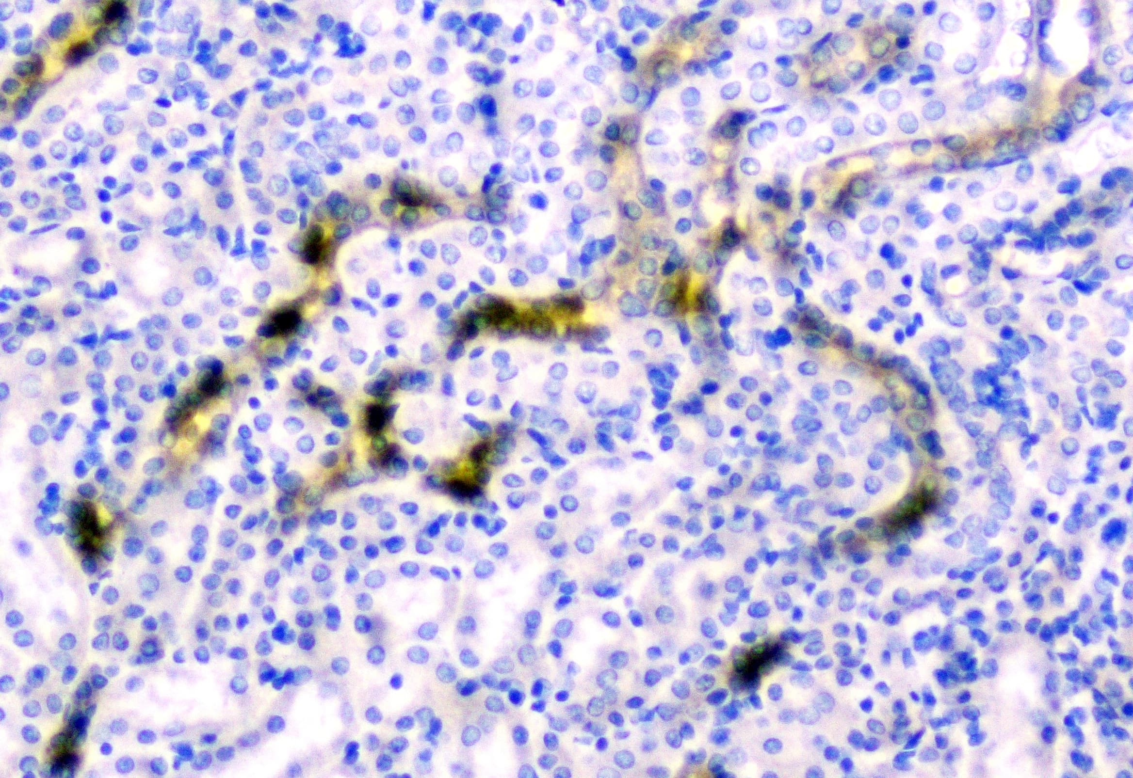 CD2AP Antibody