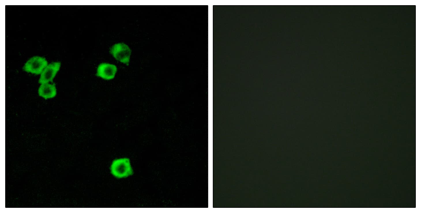 IHC-plus™ Polyclonal Rabbit anti-Human RPS6KC1 Antibody (aa231-280, IHC, IF, WB)