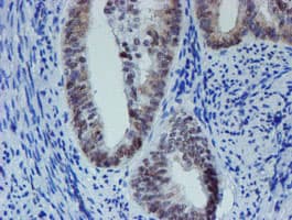 METTL16 / METT10D Antibody (clone OTI3B5)